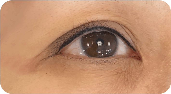 PMU偽妝 眼線修復過程 02隱形眼線