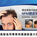 PMU偽裝NPM魔術真髮 NPM頭皮理療 01