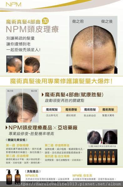 哈魯享生活 拯救禿頭缺髮照顧頭皮健康 NPM魔術真髮01